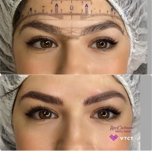 Microblading advanced skin treatments - Before & after