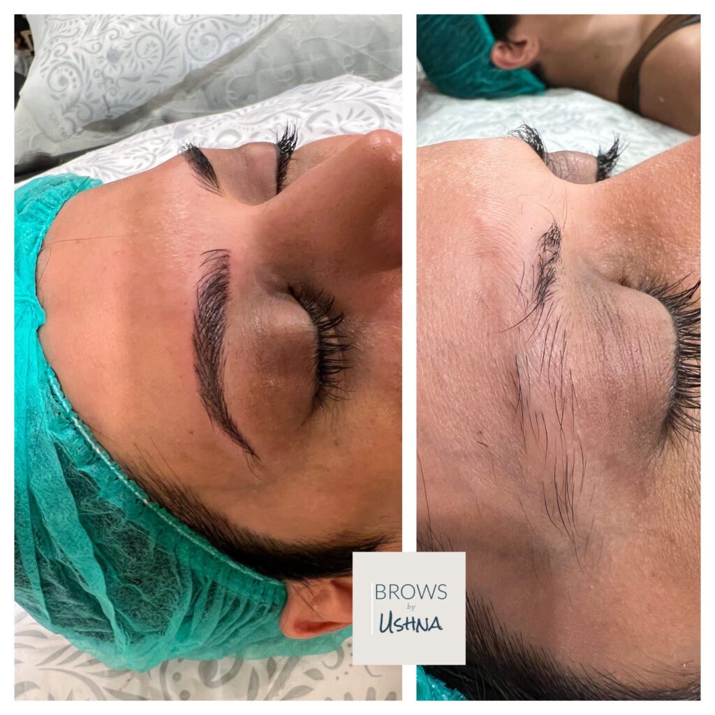 Before and After Microblading Treatment