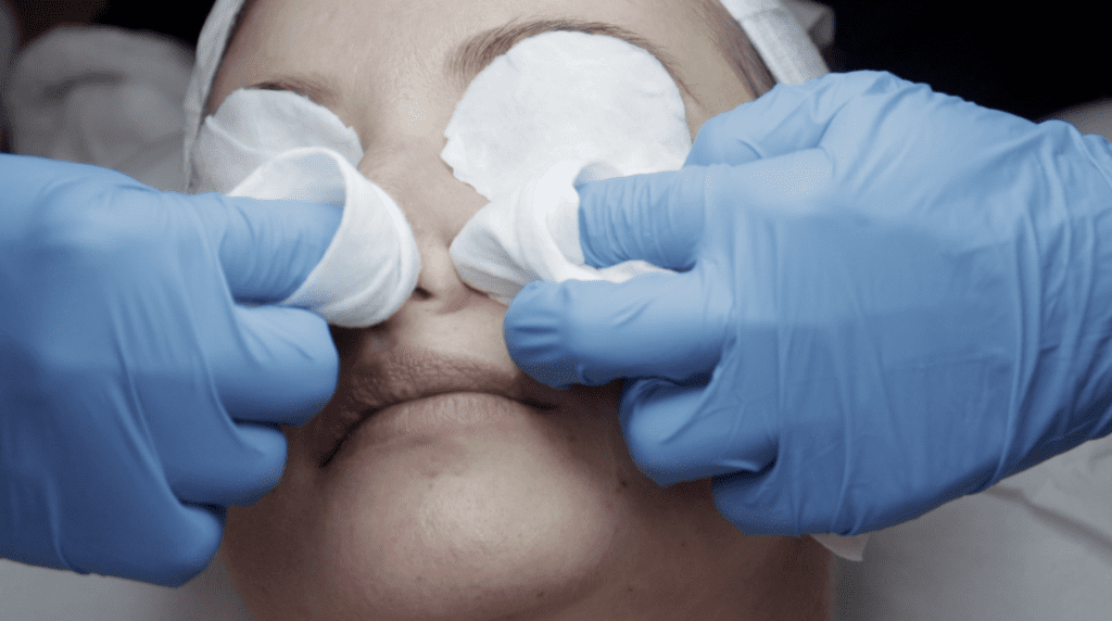 step by step professional facial guide step 6 extracting blackheads and whiteheads